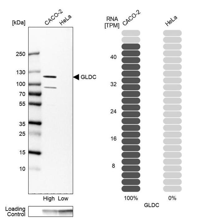 GLDC Antibody in Western Blot (WB)