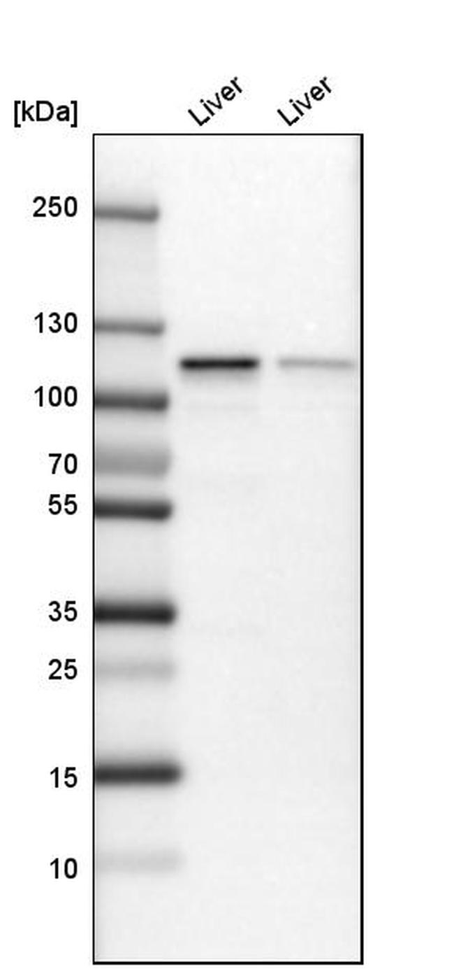 GLDC Antibody in Western Blot (WB)