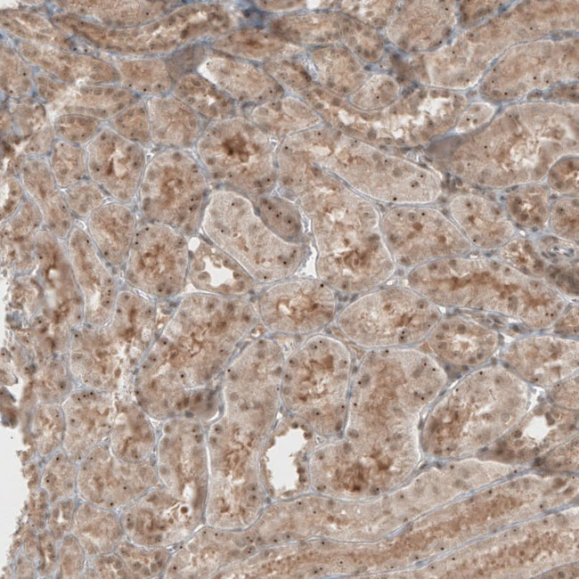 KIAA0020 Antibody in Immunohistochemistry (IHC)