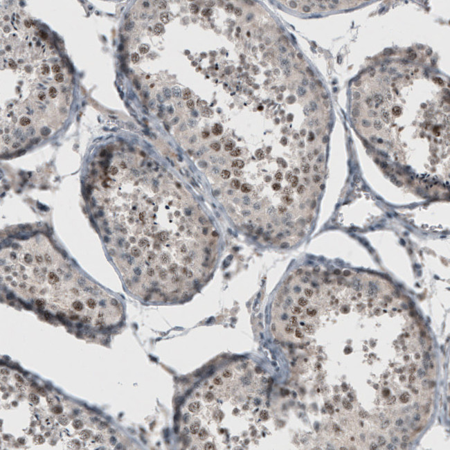 KIAA0020 Antibody in Immunohistochemistry (IHC)