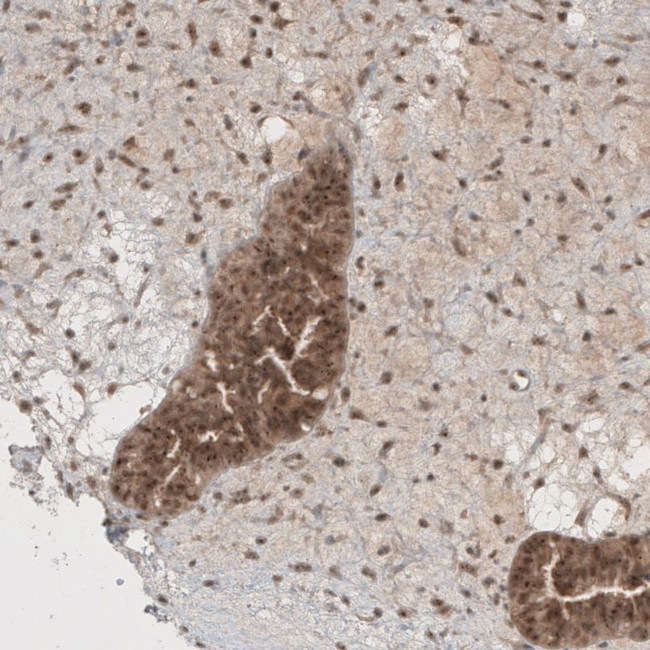 KIAA0020 Antibody in Immunohistochemistry (IHC)