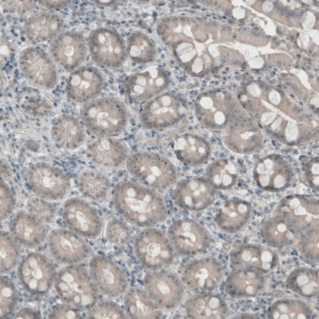 KIAA0020 Antibody in Immunohistochemistry (IHC)