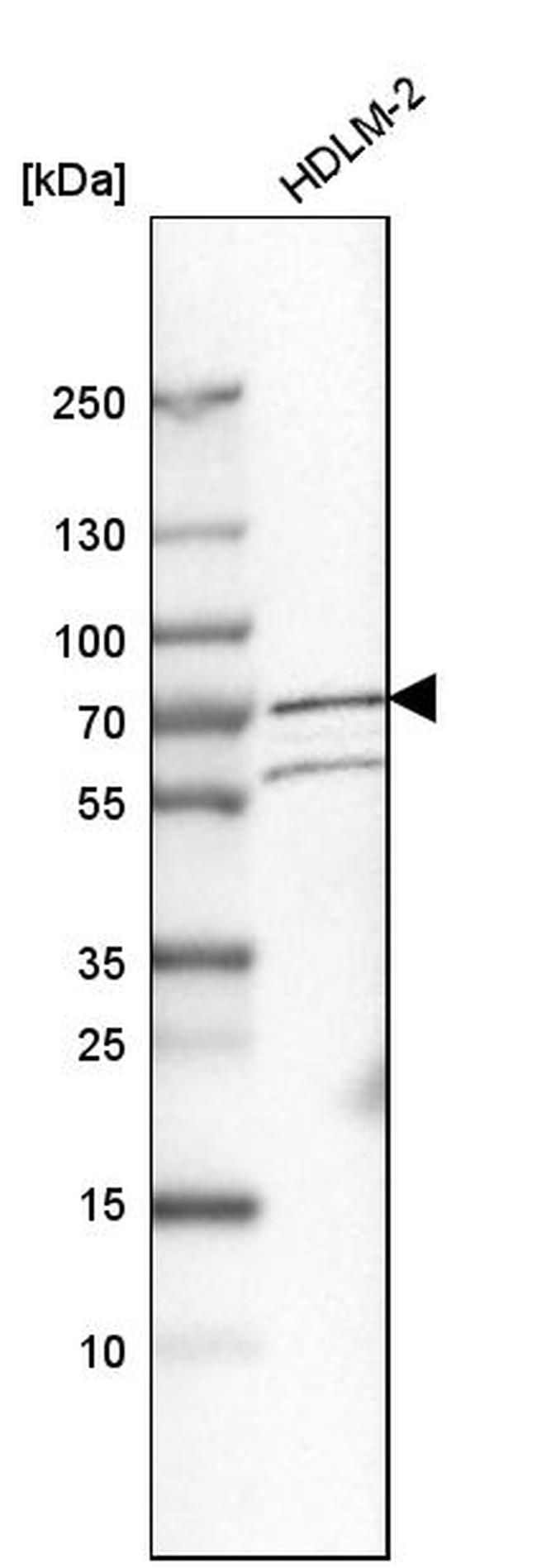 KIAA0020 Antibody in Western Blot (WB)