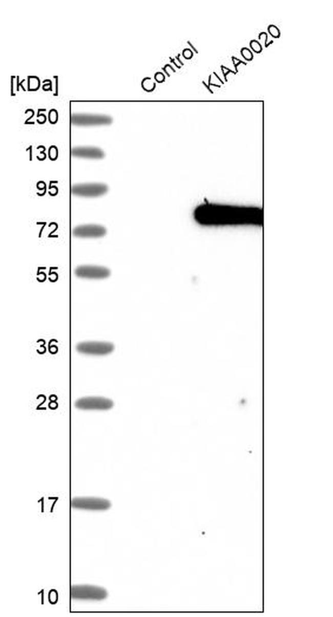 KIAA0020 Antibody in Western Blot (WB)