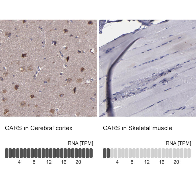 CARS Antibody in Immunohistochemistry (IHC)