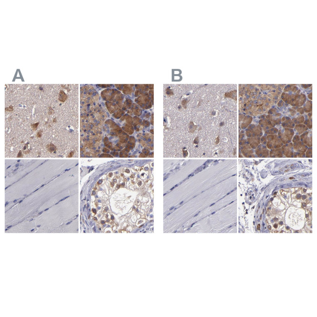 CARS Antibody in Immunohistochemistry (IHC)