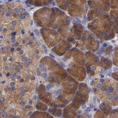 CARS Antibody in Immunohistochemistry (IHC)