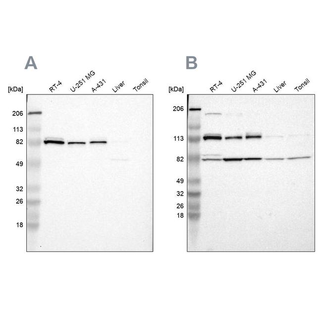 CARS Antibody in Western Blot (WB)