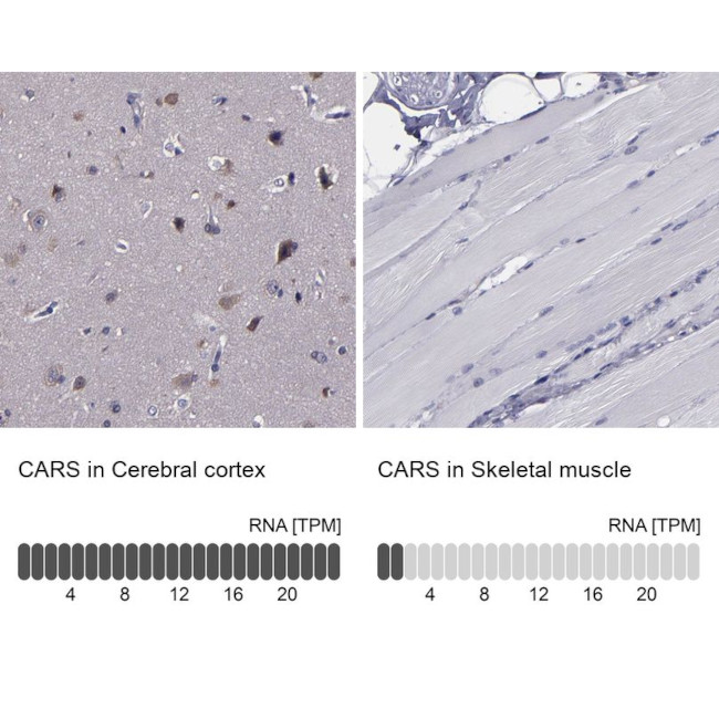 CARS Antibody in Immunohistochemistry (IHC)