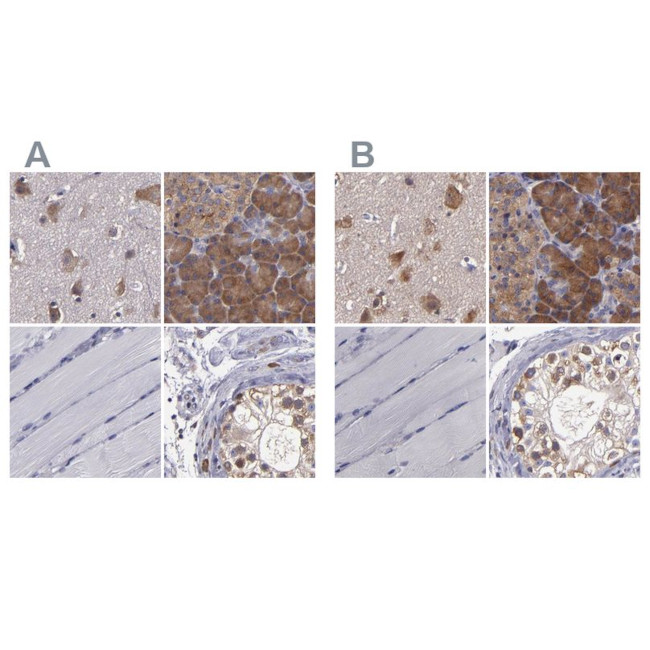 CARS Antibody in Immunohistochemistry (IHC)