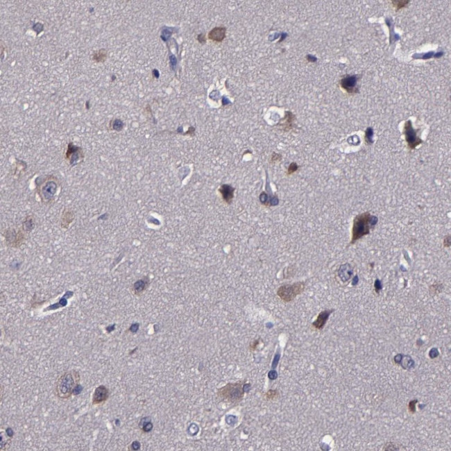 CARS Antibody in Immunohistochemistry (IHC)