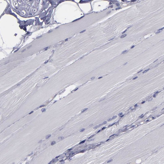 CARS Antibody in Immunohistochemistry (IHC)