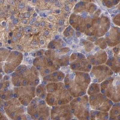 CARS Antibody in Immunohistochemistry (IHC)