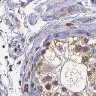 CARS Antibody in Immunohistochemistry (IHC)