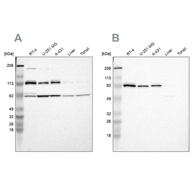 CARS Antibody in Western Blot (WB)