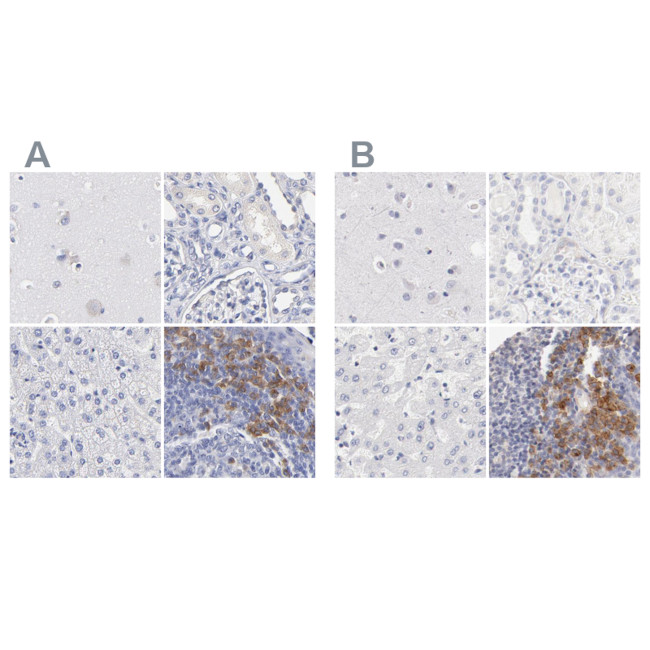 LAX1 Antibody in Immunohistochemistry (IHC)