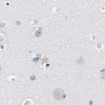 LAX1 Antibody in Immunohistochemistry (IHC)