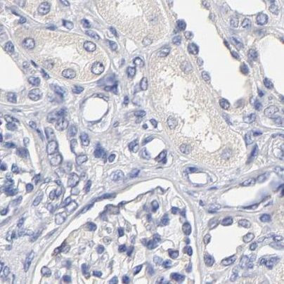 LAX1 Antibody in Immunohistochemistry (IHC)