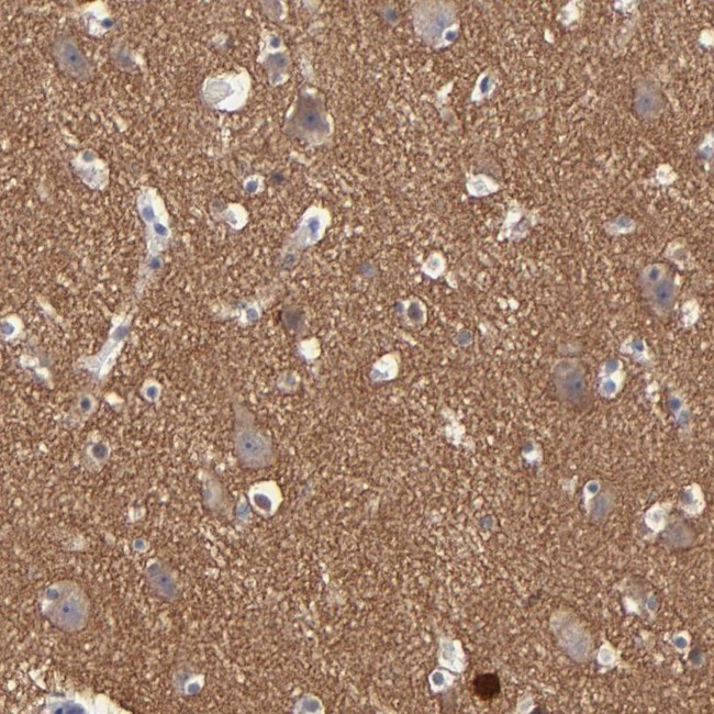 RPH3A Antibody in Immunohistochemistry (IHC)