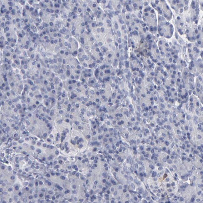 RPH3A Antibody in Immunohistochemistry (IHC)