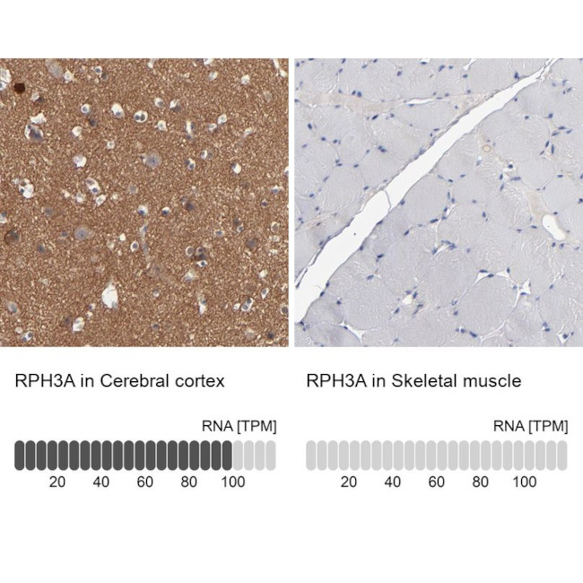 RPH3A Antibody