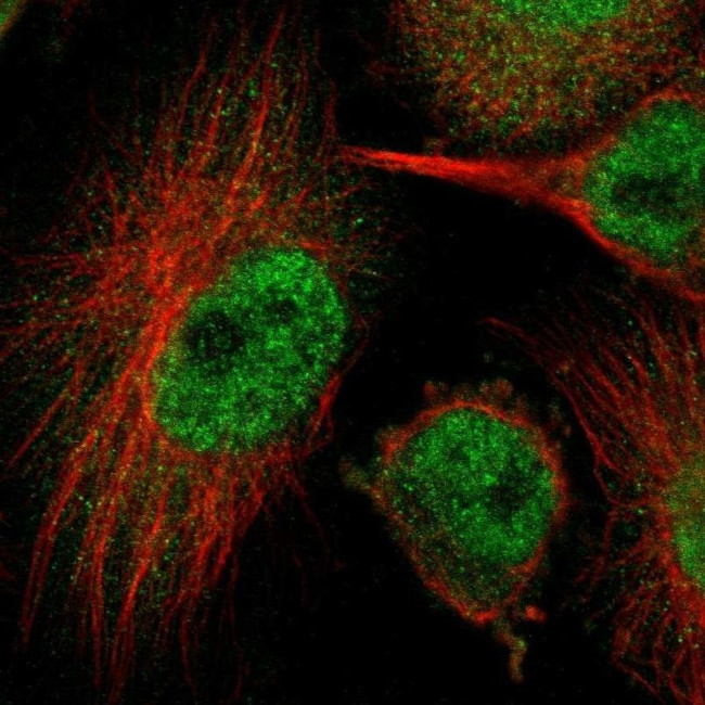 HUWE1 Antibody in Immunocytochemistry (ICC/IF)