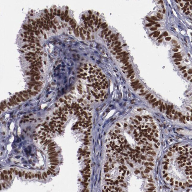 ERH Antibody in Immunohistochemistry (IHC)