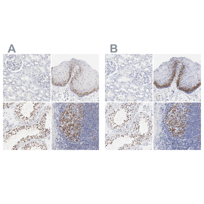 NCAPH Antibody in Immunohistochemistry (IHC)