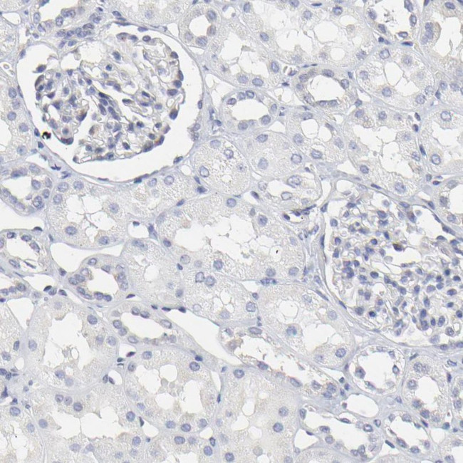 NCAPH Antibody in Immunohistochemistry (IHC)