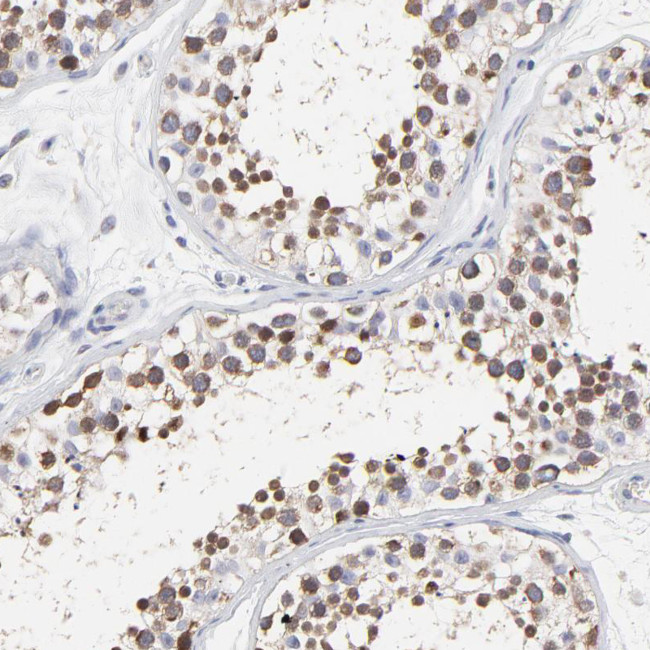 NCAPH Antibody in Immunohistochemistry (IHC)