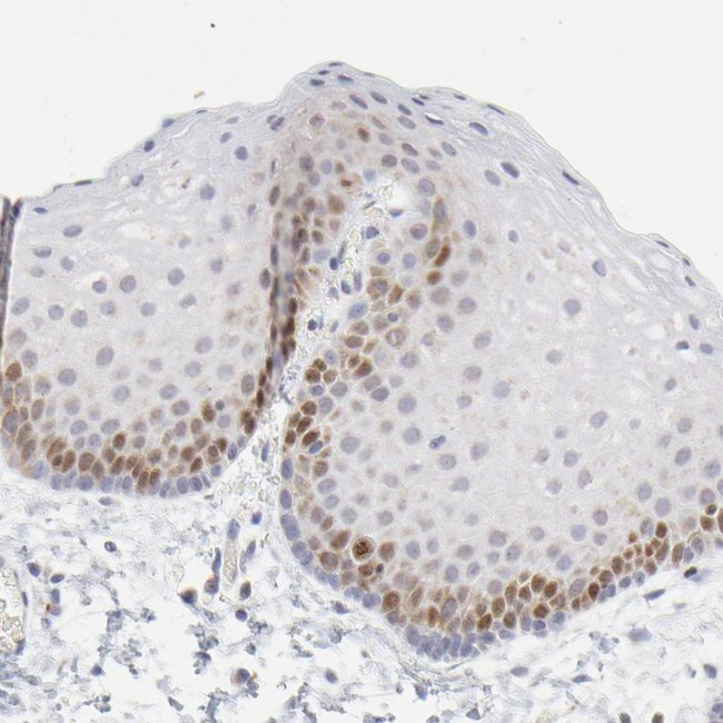 NCAPH Antibody in Immunohistochemistry (IHC)