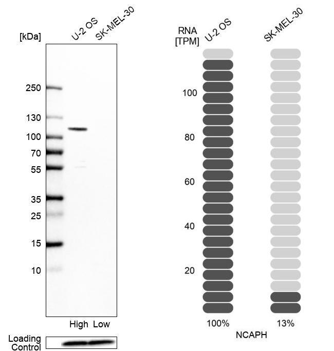 NCAPH Antibody in Western Blot (WB)