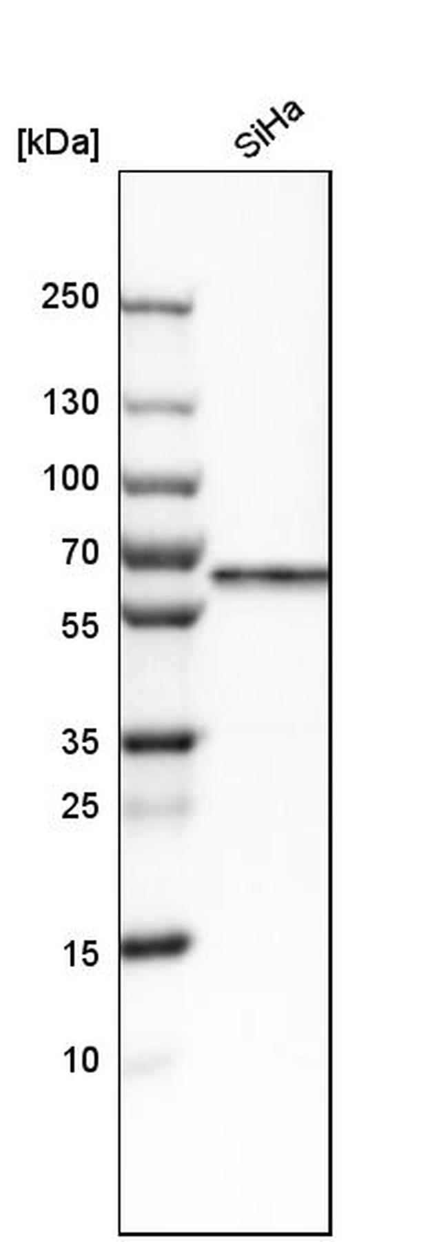 Carboxypeptidase M Antibody in Western Blot (WB)