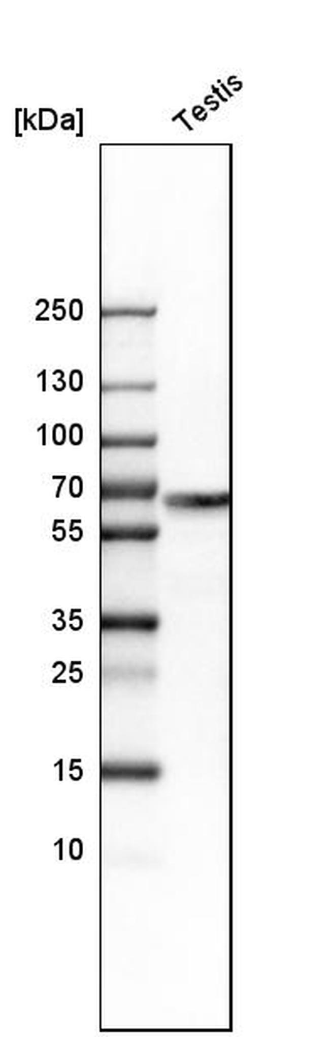 WASH1 Antibody in Western Blot (WB)