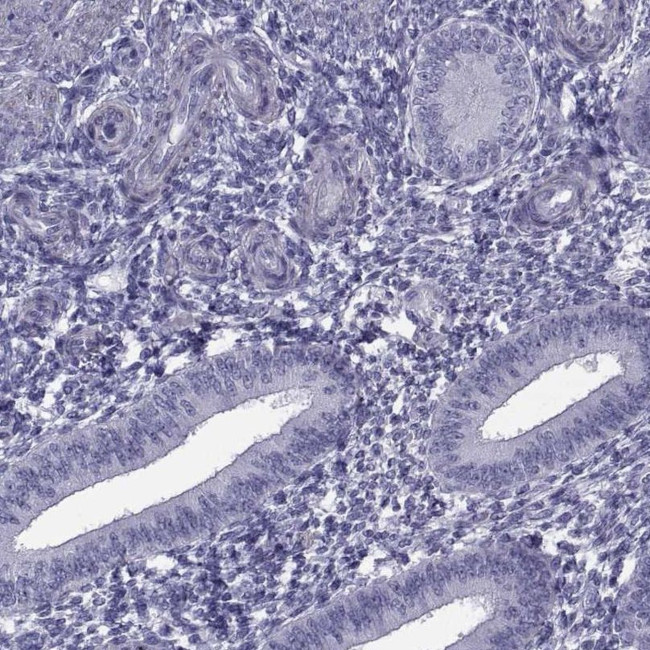 MAGEB1 Antibody in Immunohistochemistry (IHC)