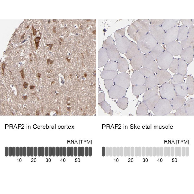 JM4 Antibody in Immunohistochemistry (IHC)