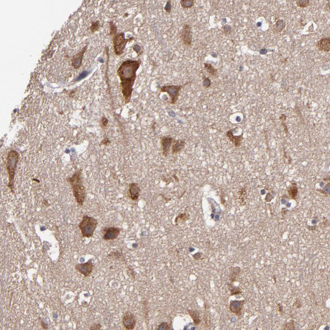 JM4 Antibody in Immunohistochemistry (IHC)