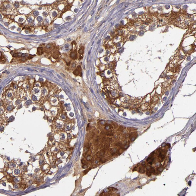 JM4 Antibody in Immunohistochemistry (IHC)