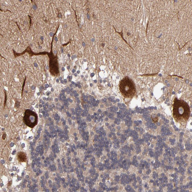 JM4 Antibody in Immunohistochemistry (IHC)