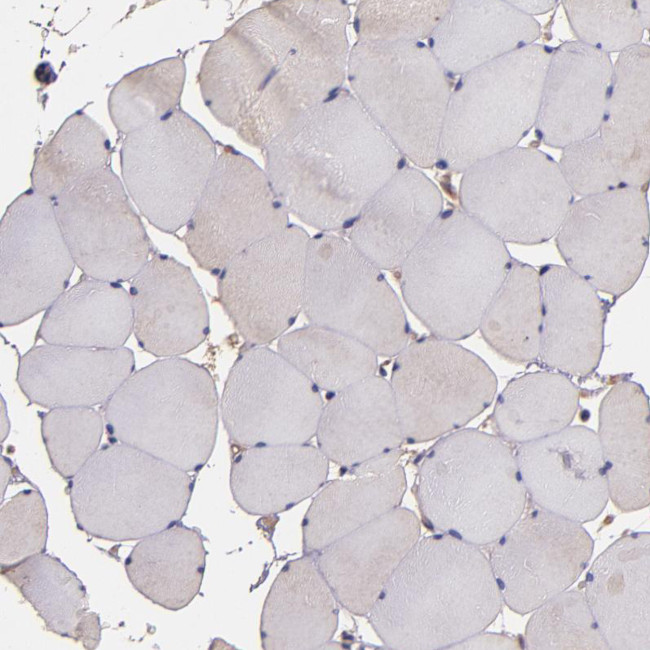 JM4 Antibody in Immunohistochemistry (IHC)