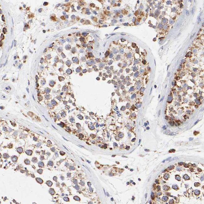 SSBP1 Antibody in Immunohistochemistry (IHC)