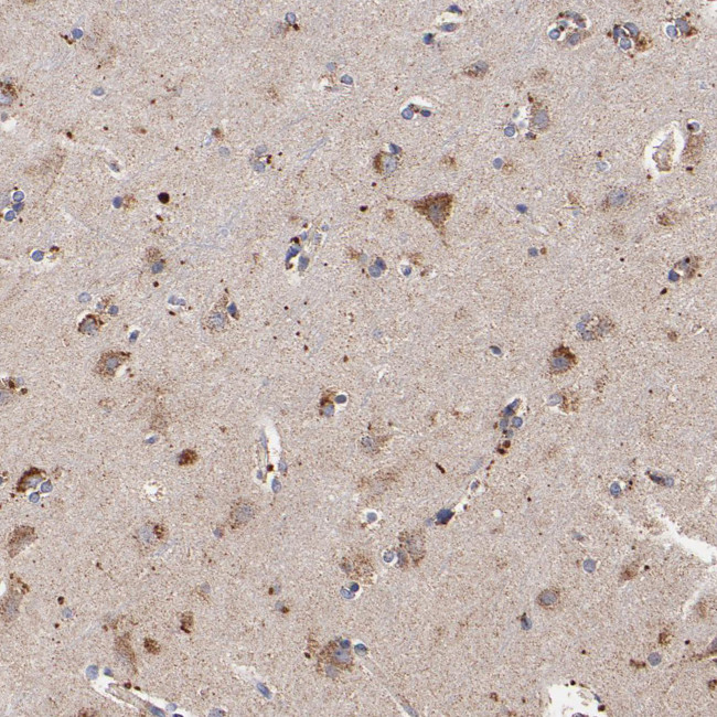 SSBP1 Antibody in Immunohistochemistry (IHC)