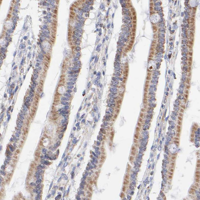 SSBP1 Antibody in Immunohistochemistry (IHC)