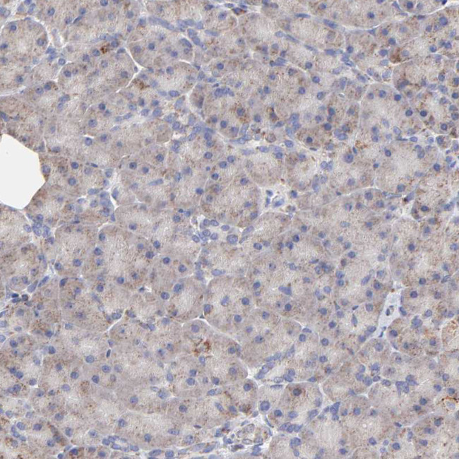 SSBP1 Antibody in Immunohistochemistry (IHC)