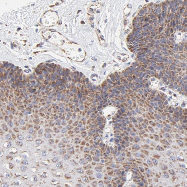 SSBP1 Antibody in Immunohistochemistry (IHC)