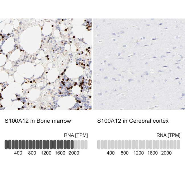 S100A12 Antibody in Immunohistochemistry (IHC)