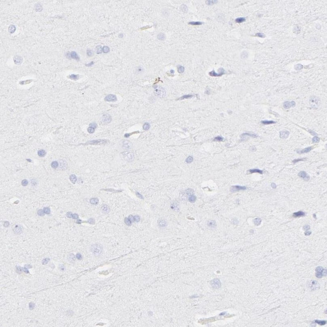 S100A12 Antibody in Immunohistochemistry (IHC)