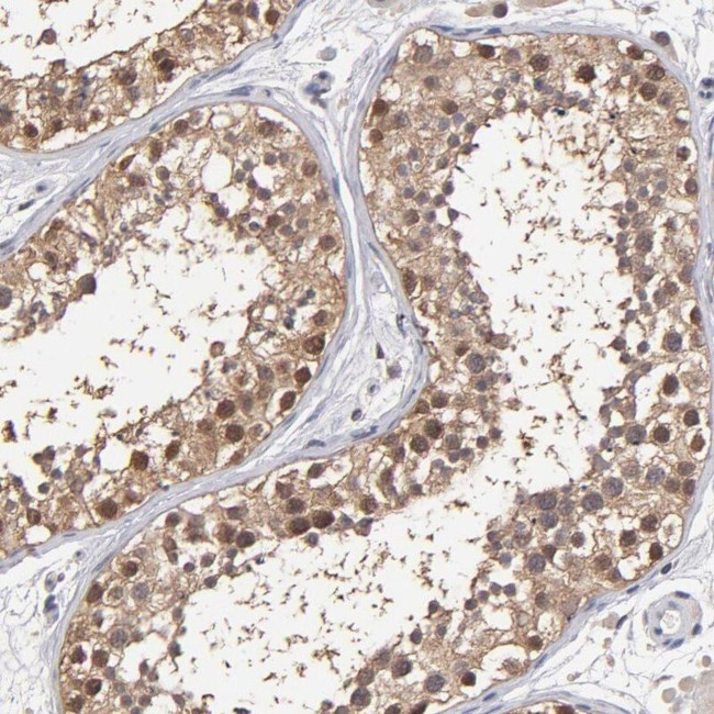 PSMD10 Antibody in Immunohistochemistry (IHC)