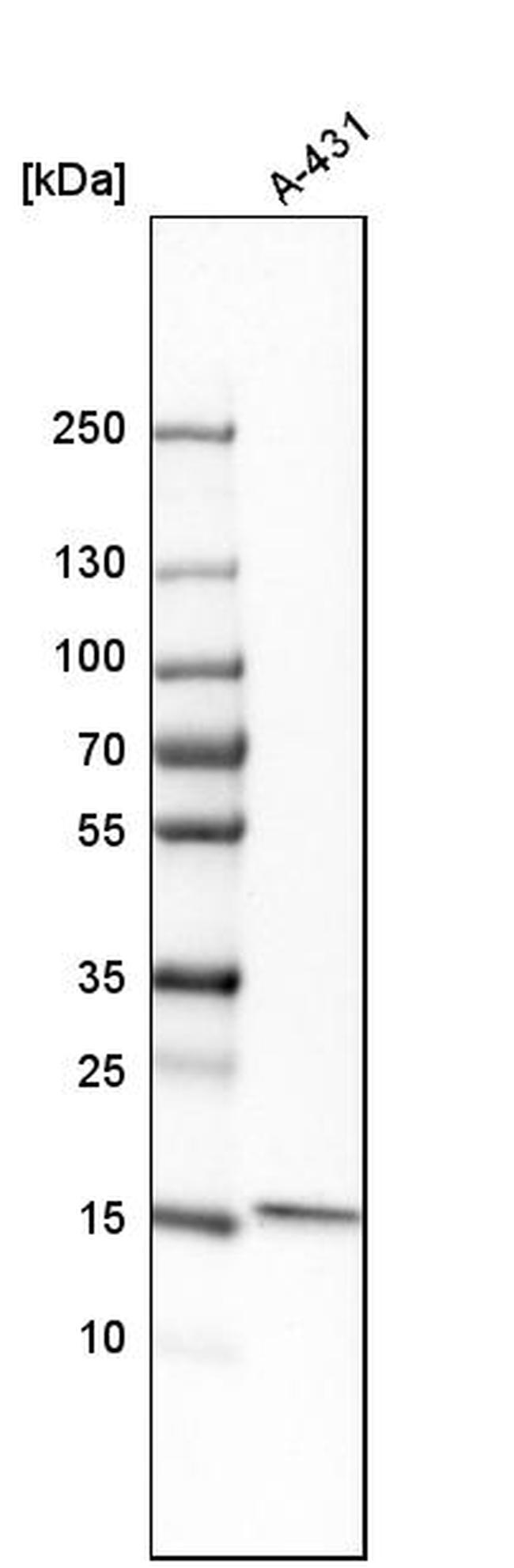 GMFB Antibody in Western Blot (WB)