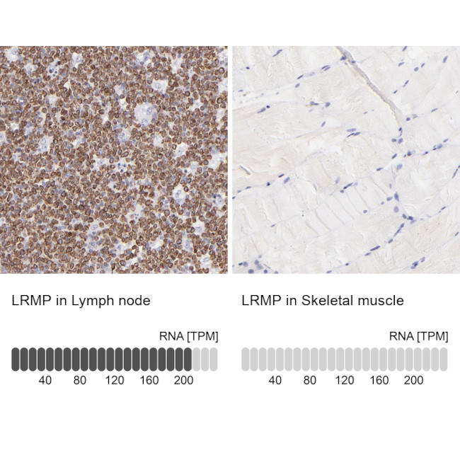 Lrmp Antibody in Immunohistochemistry (IHC)